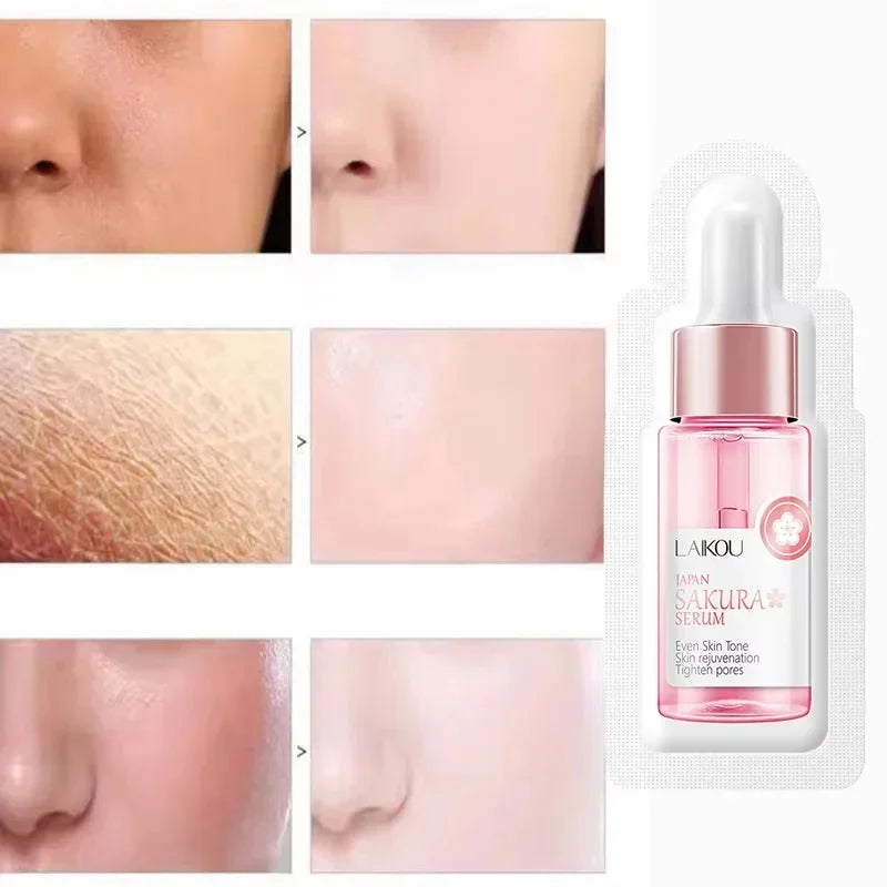 Sakura Whitening Gesichts-Serum Anti-Aging Verblasst feine Linien Strafft Poren Verbessert Melaninpigment Stumpfer Feuchtigkeitsspender Hellt die Hautpflege auf